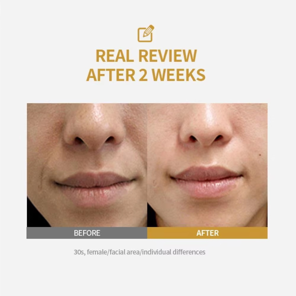 أمبولة رفع مكثفة من الببتيد، م - مراجعة Collagen Peptide Powder وسعره