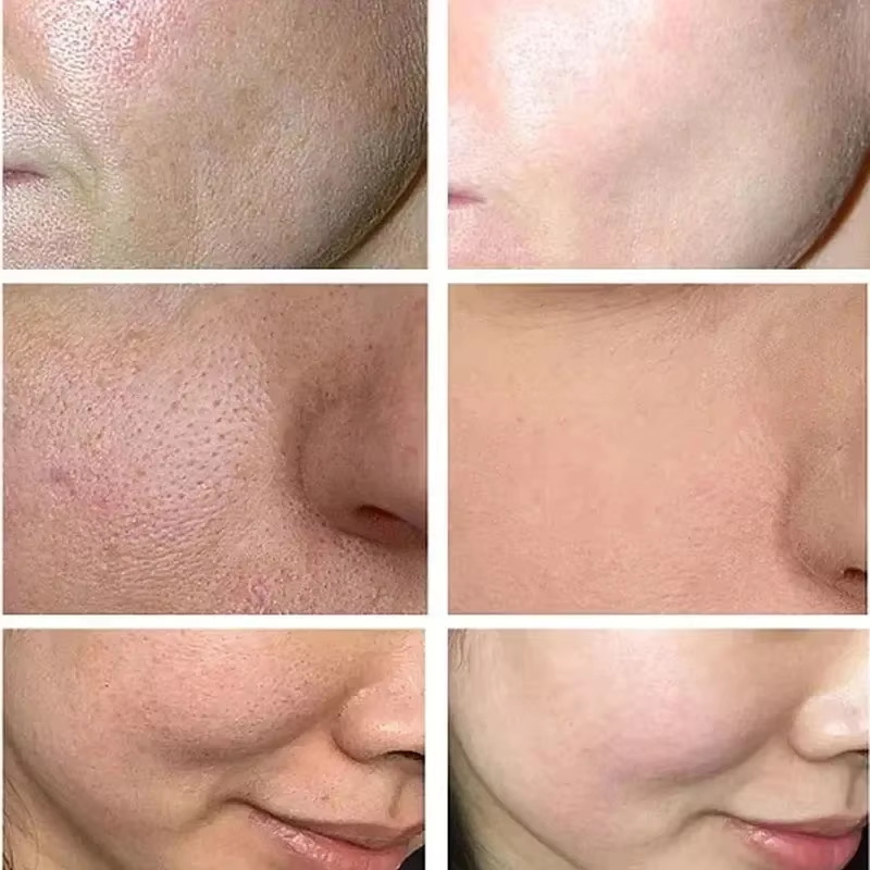 كريم حمض الساليسيليك لتقليل ال - مراجعة Collagen Peptide Powder وسعره