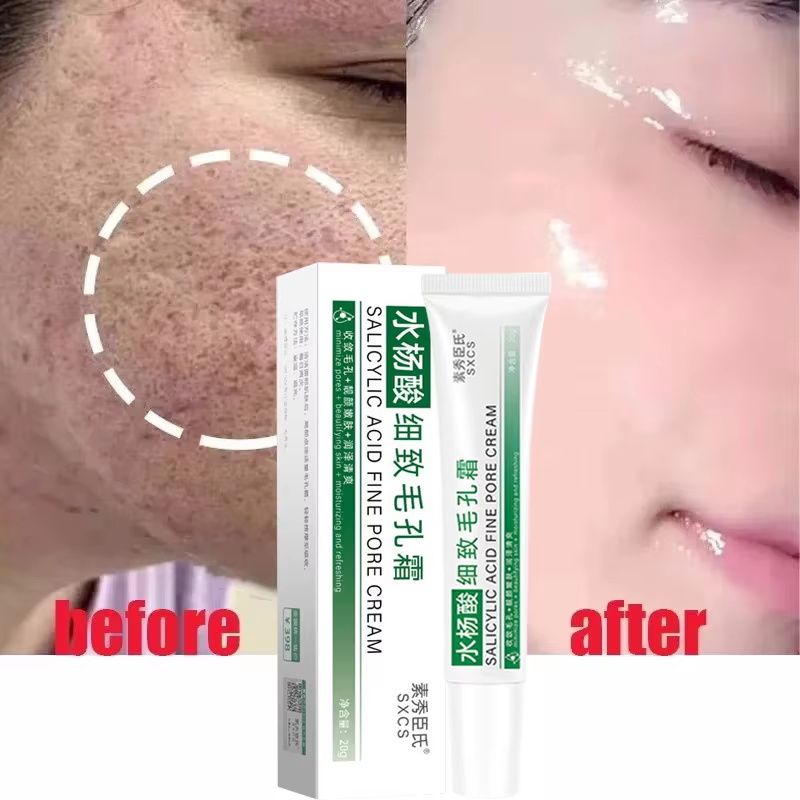 كريم حمض الساليسيليك لتقليل ال - مراجعة Collagen Peptide Powder وسعره