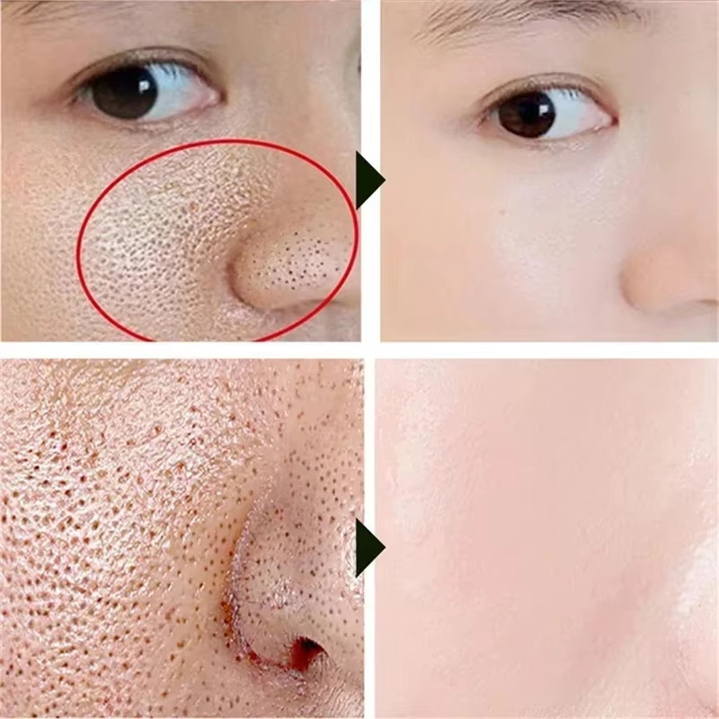 كريم حمض الساليسيليك لتقليل ال - مراجعة Collagen Peptide Powder وسعره